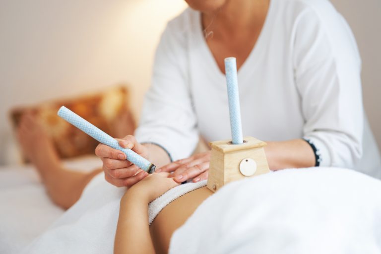 moxibustion